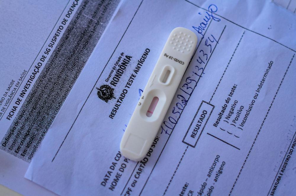 Relatório covid-19 deixará de ser diário e passará a ser semanal